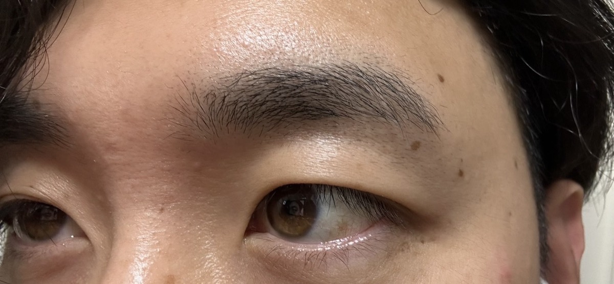 施術前の眉。眉の上下にムダ毛が生えて輪郭がぼやけている状態