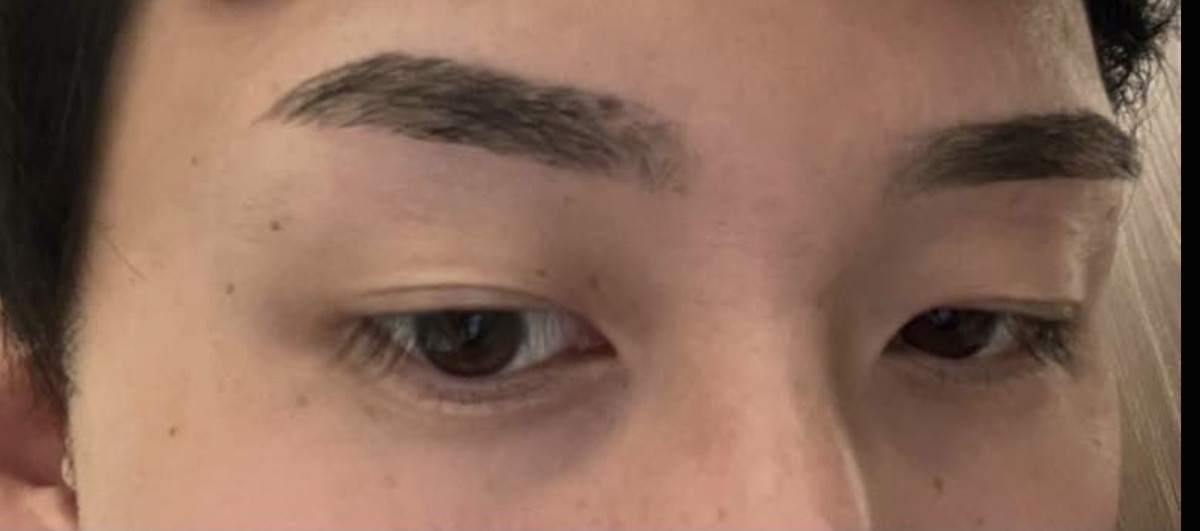 眉のワックス脱毛直後。整っているが数週間で元に戻る